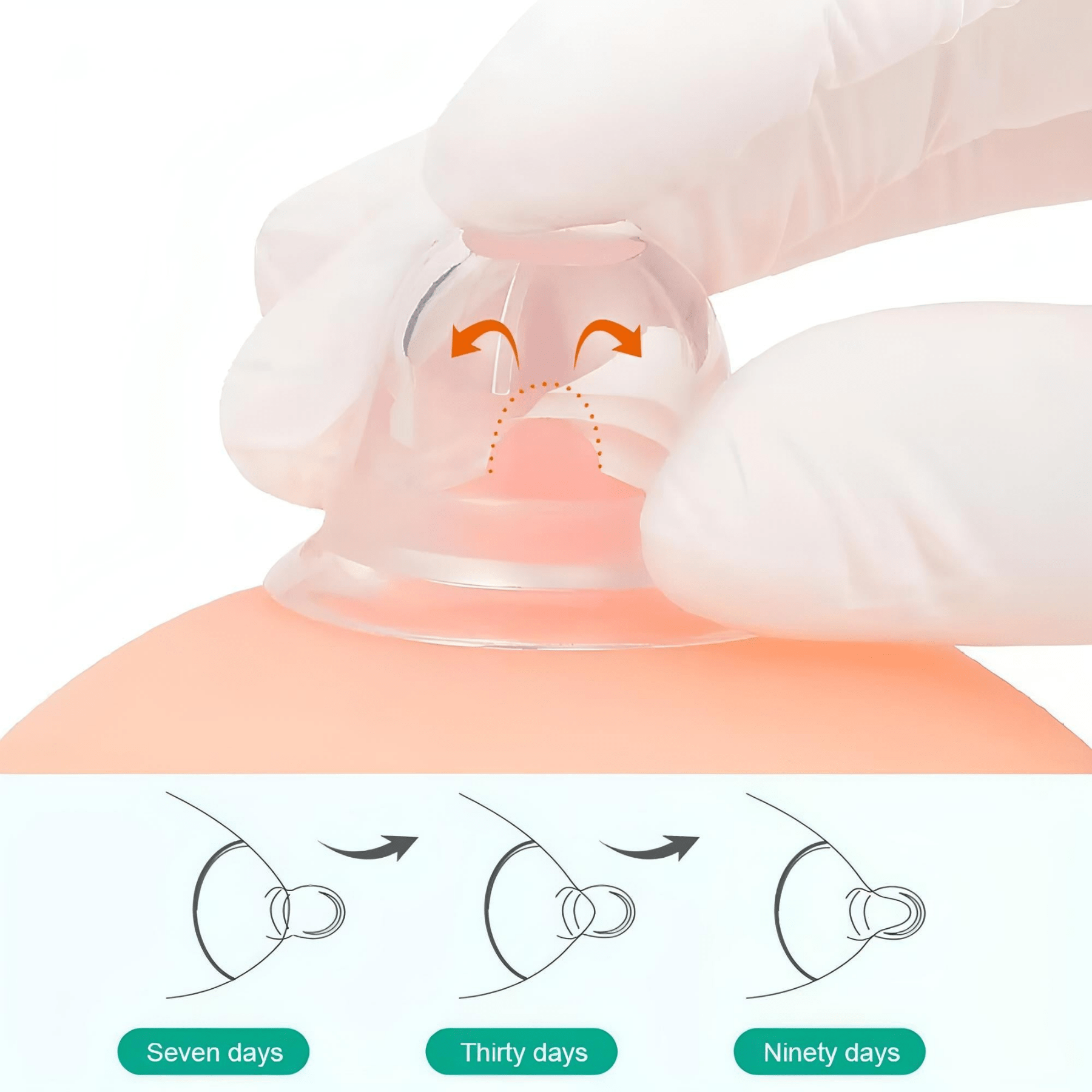 Momsolutions Nipple Corrector